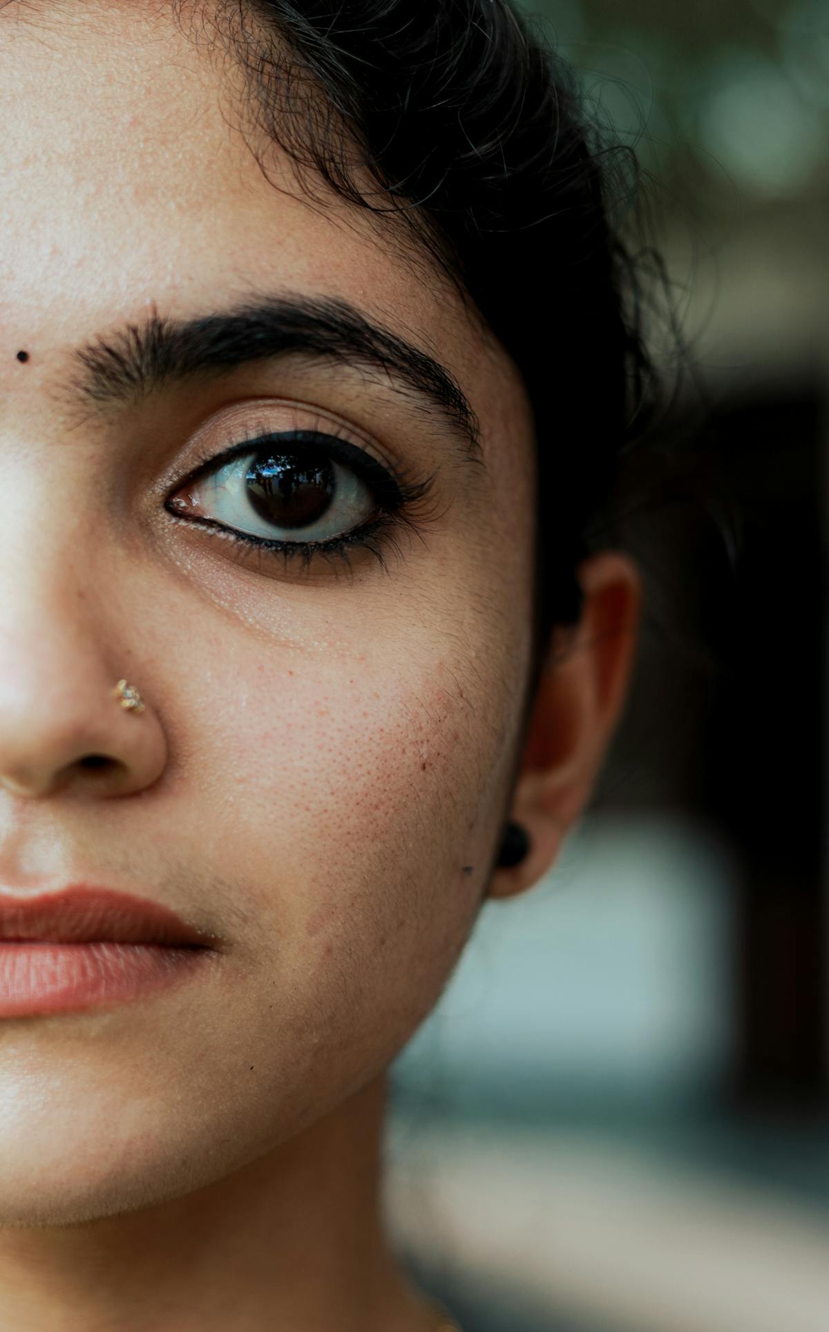 Hyperpigmentation treatment
